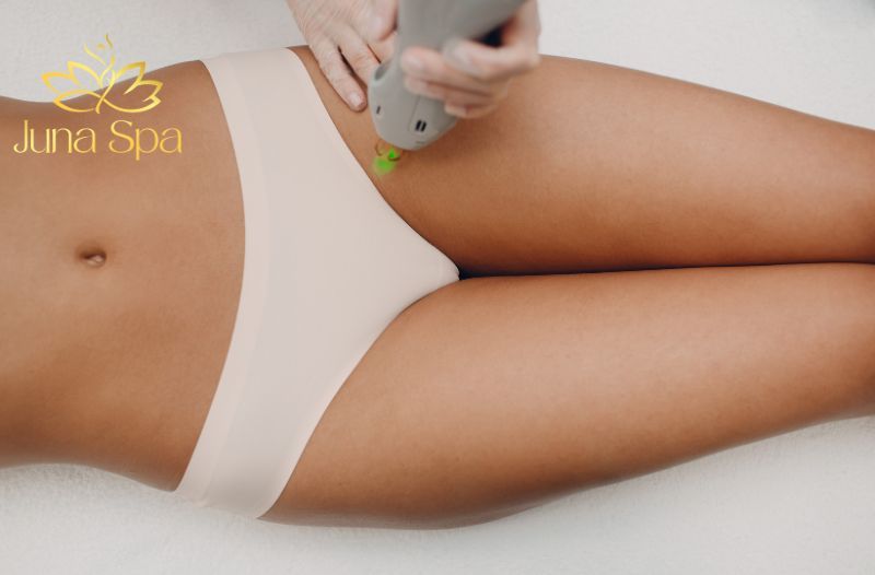 triệt lông bikini