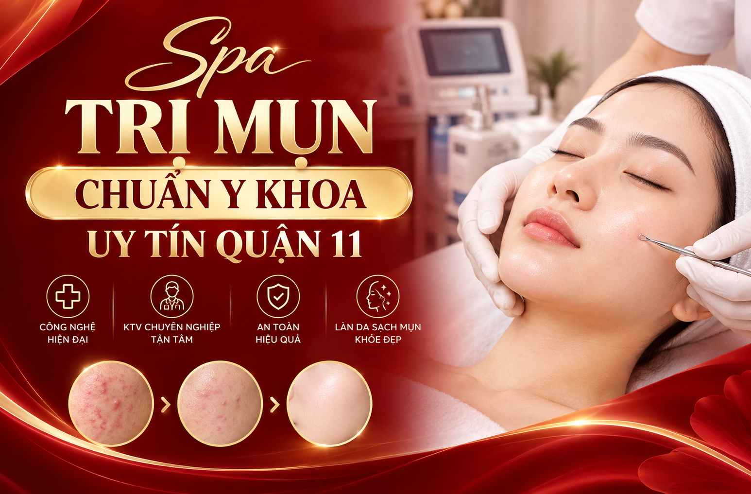 Spa trị mụn chuẩn y khoa uy tín quận 11