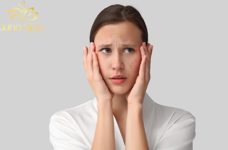 Mụn trứng cá, mụn viêm nổi lên sau Tết: Lý do và cách chăm sóc hiệu quả