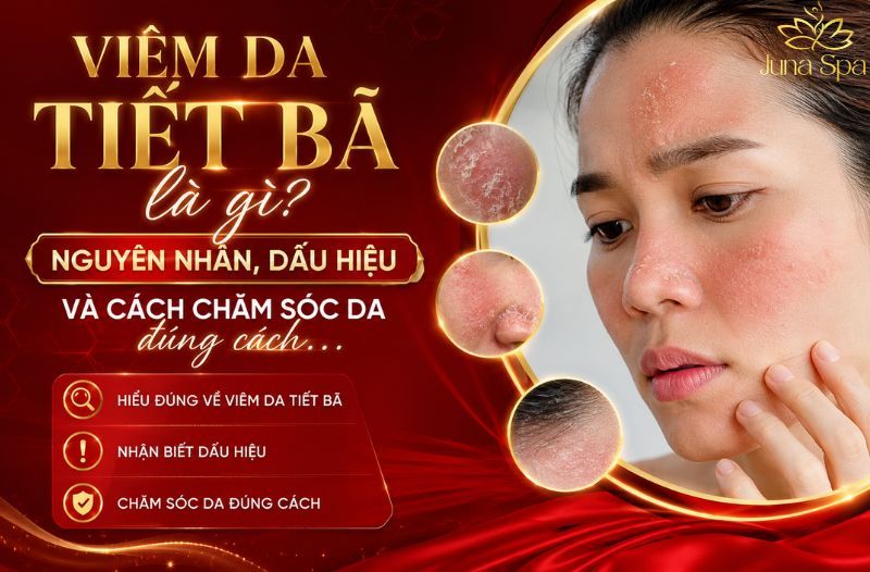 Viêm da tiết bã là gì? Nguyên nhân, dấu hiệu và cách chăm sóc da đúng cách