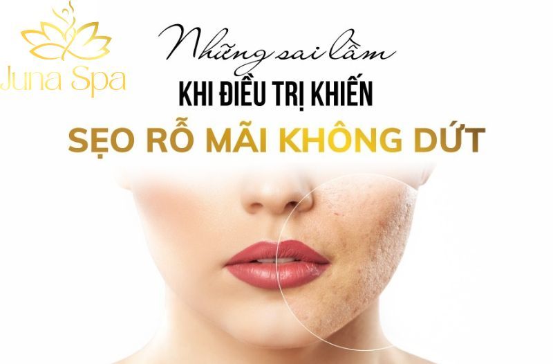 sai lầm khi trị sẹo rổ