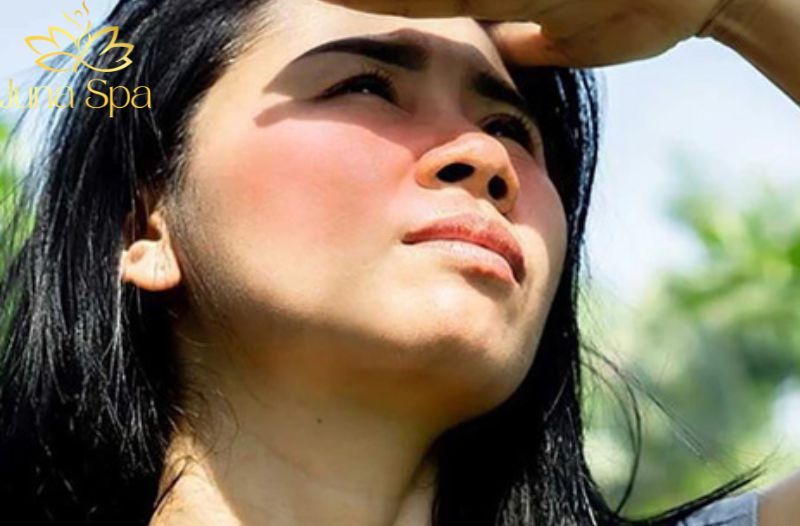 Mùa hè - “Kẻ thù” của nám và tàn nhang: Nguyên nhân và cách chăm sóc da phù hợp