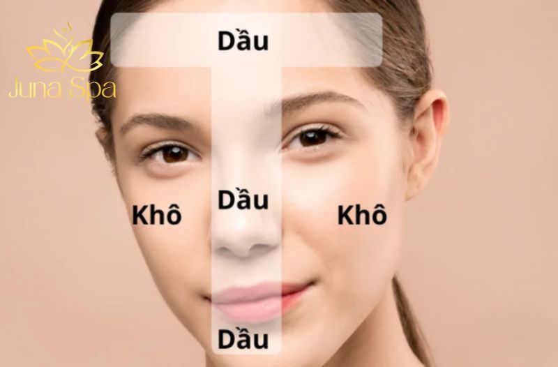 vùng da chữ T