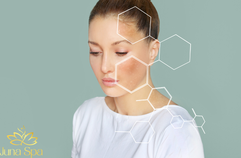 Da “xuống cấp” hậu Tết: 5 dấu hiệu thường gặp và cách phục hồi đúng chuẩn spa