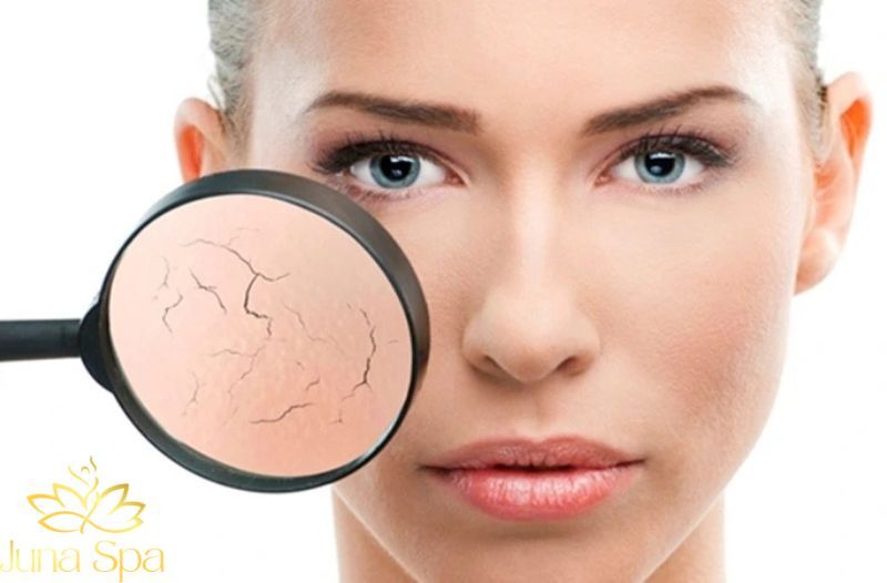 Những điều khiến hàng rào da yếu đi mà nhiều người không ngờ tới
