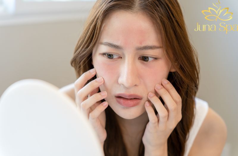 Đỏ mặt và căng rát sau khi rửa mặt là biểu hiện điển hình của da khô