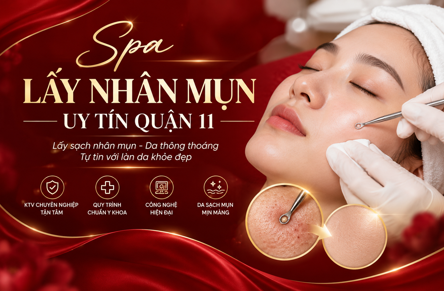 Spa lấy nhân mụn uy tín Quận 11