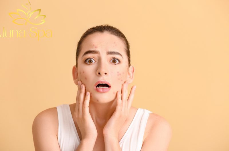 Các thói quen cần thay đổi trước khi chăm sóc da bị mụn hiệu quả