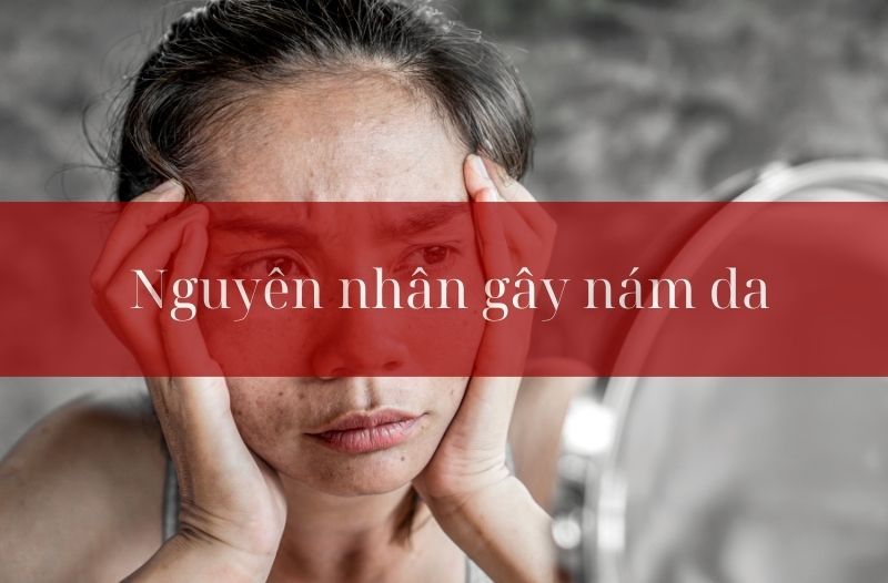 nguyên nhân gây nám da