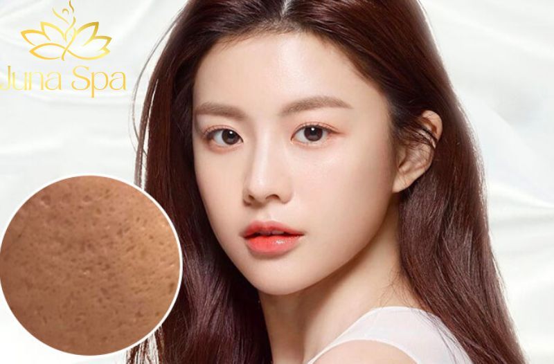Trị Sẹo Rổ Junlab Pitted Scars
