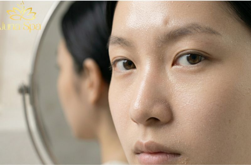 Làn da “đổ dầu nhưng vẫn bong tróc”: Hiểu đúng để chăm sóc đúng
