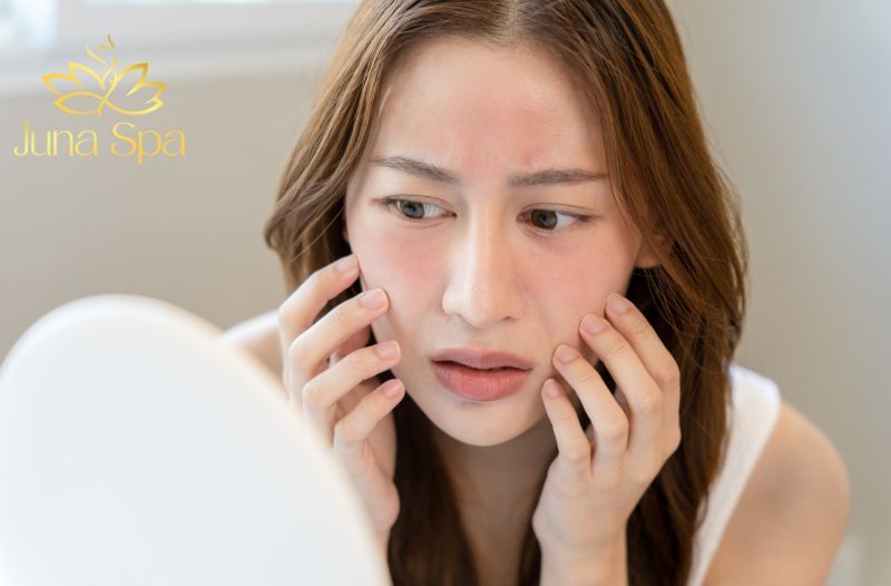 mụn trên da