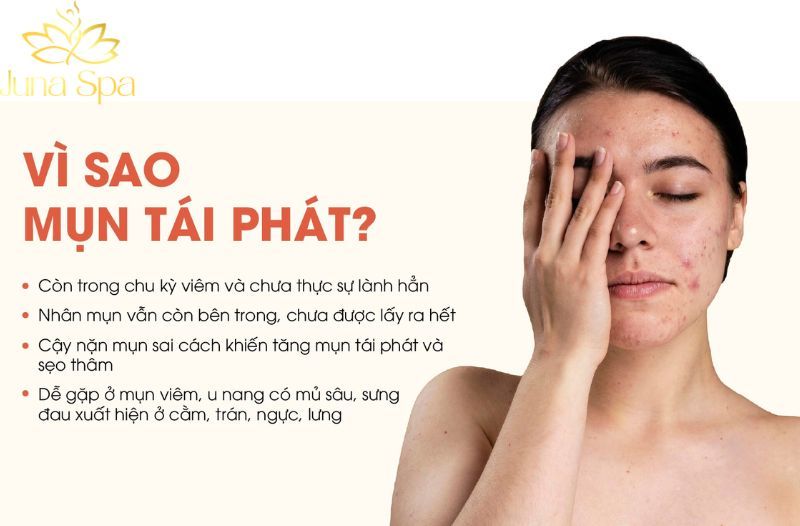 Da vừa hết mụn lại nổi: Có phải do mất cân bằng?
