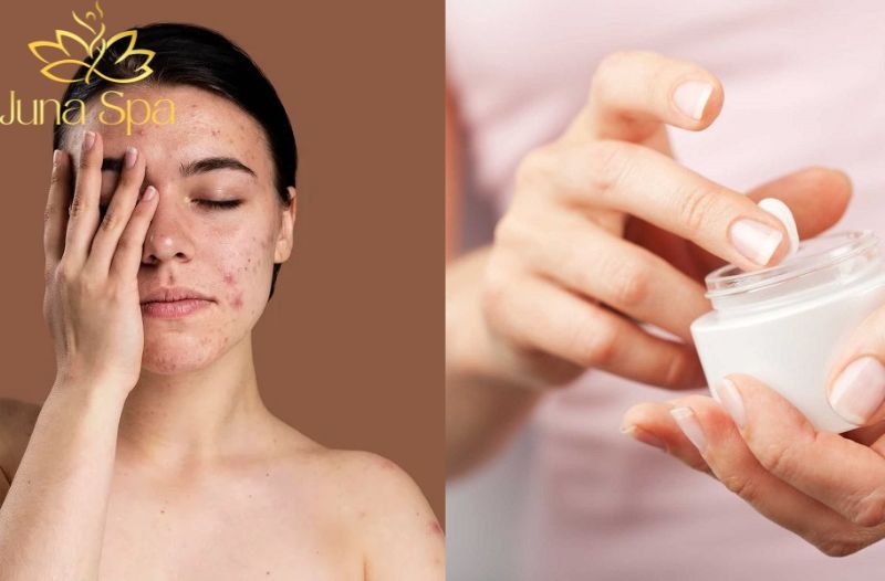 Ngừng dùng sản phẩm dưỡng trắng da có bị sậm màu trở lại không?