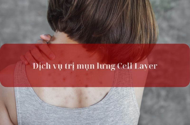 trị mụn lưng Cell Layer