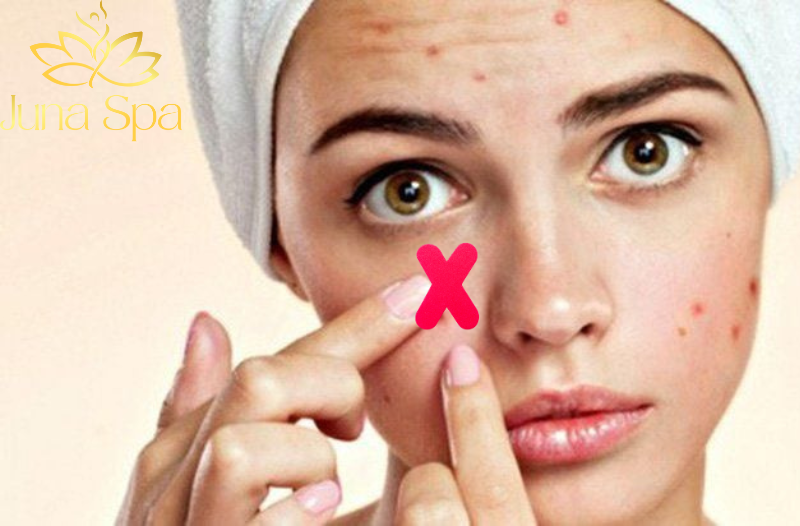 Các loại mụn nên và không nên lấy nhân mụn
