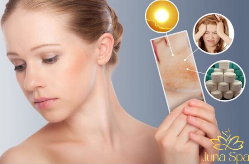 Da yếu trước Tết: Khi nào nên phục hồi thay vì làm treatment mạnh?