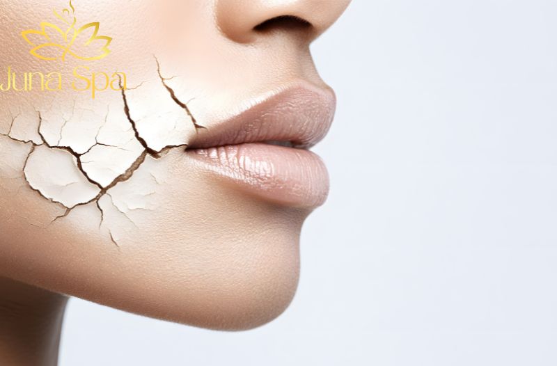 Làn da khô ráp và bong tróc do thời tiết hanh khô