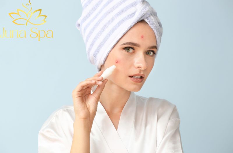 Các biện pháp trị mụn được ưa chuộng hiện nay