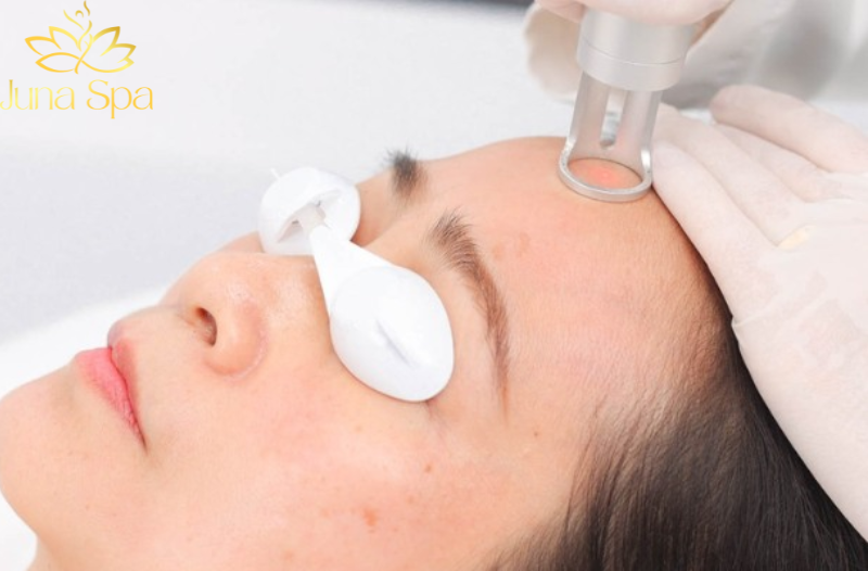 Sẹo rỗ là gì và vì sao thường khó cải thiện trong thời gian ngắn