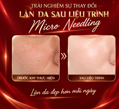 Căng bóng trẻ hóa da phù hợp với những tình trạng nào