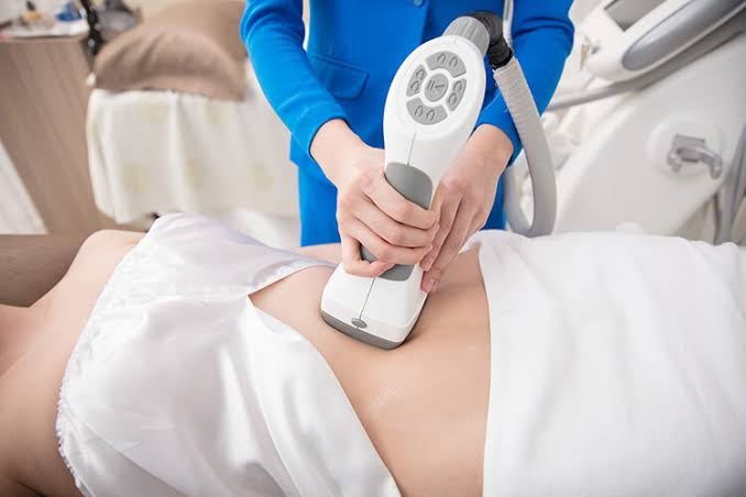 So sánh các công nghệ giảm mỡ không xâm lấn phổ biến hiện nay