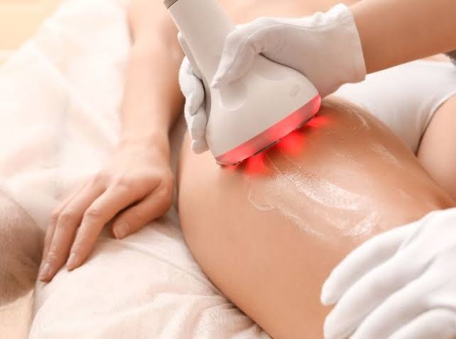 Cảm giác khi thực hiện, thời gian hồi phục và ảnh hưởng đến sinh hoạt hằng ngày