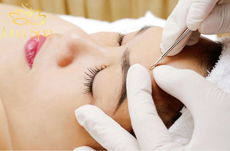 Lấy nhân mụn không đau Acne DeepClean Pro