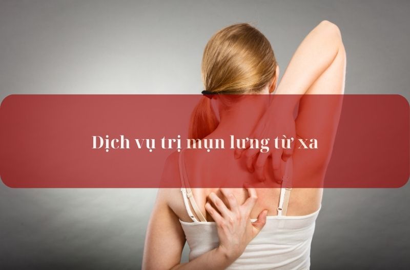 trị mụn lưng từ xa