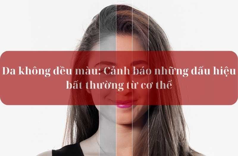 da không đều màu