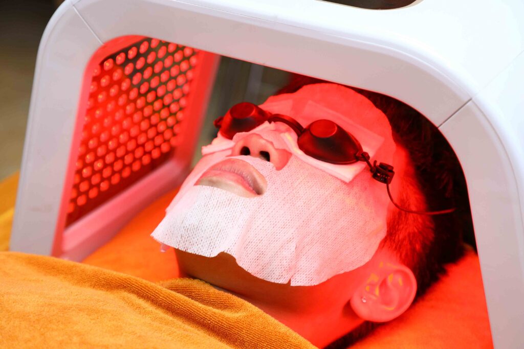 trị mụn trứng cá