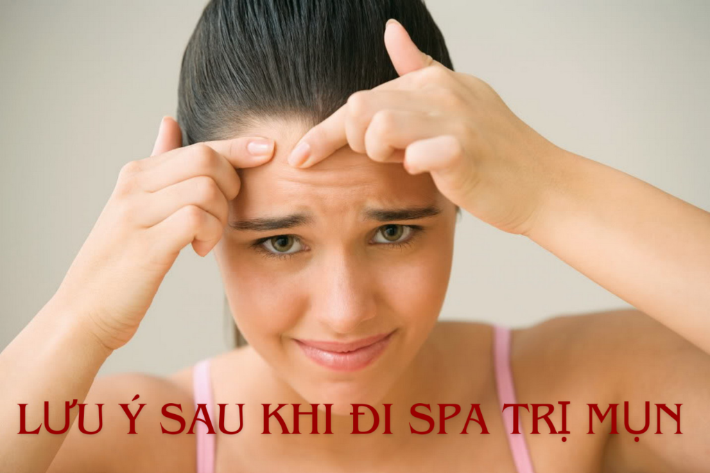 Những lưu ý sau khi đi spa trị mụn