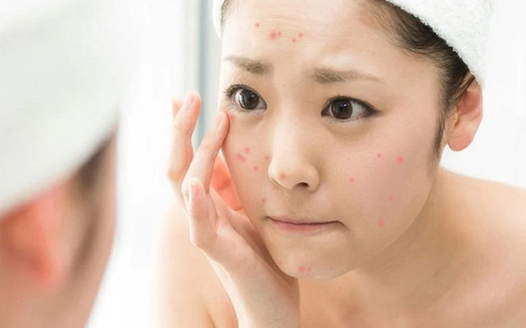 thay đổi nội tiết tố