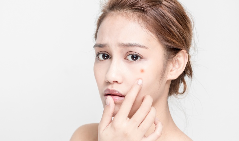 sử dụng sản phẩm trị mụn phù hợp