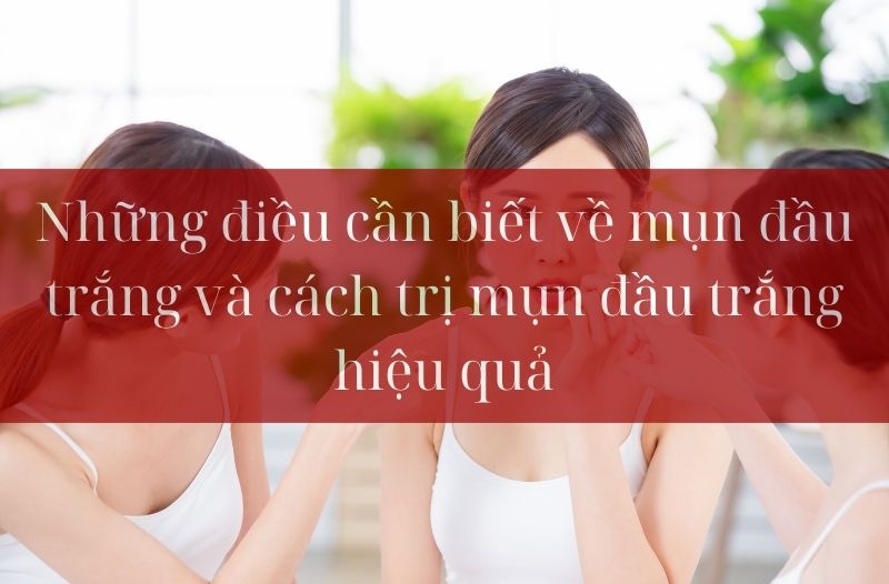 Những điều cần biết về mụn đầu trắng và cách trị mụn đầu trắng hiệu quả