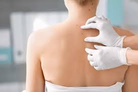 trị mụn thịt thừa bằng thuốc