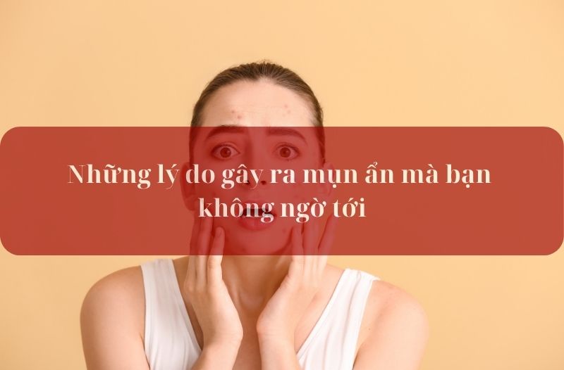 lý do gây mụn ẩn mà bạn không ngờ tới