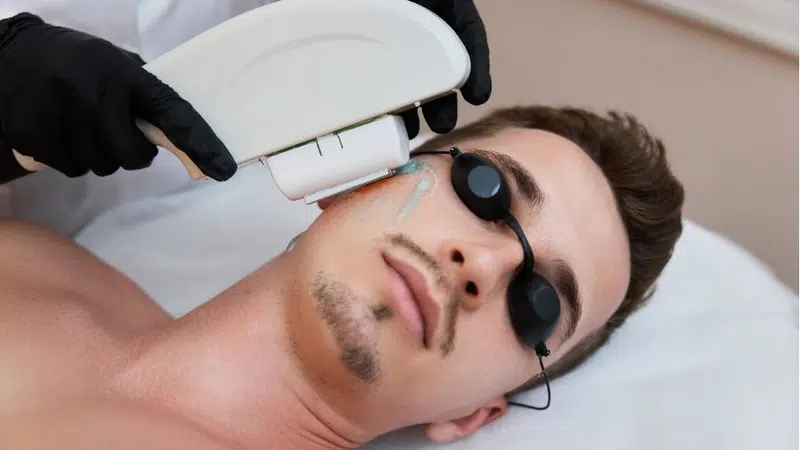 nam giới có nên triệt lông hay không