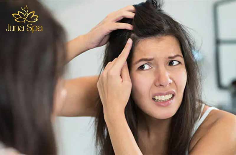 trị nấm da đầu bằng thuốc