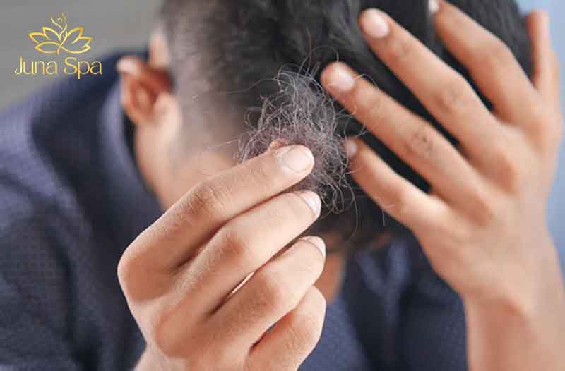 trị nấm da đầu