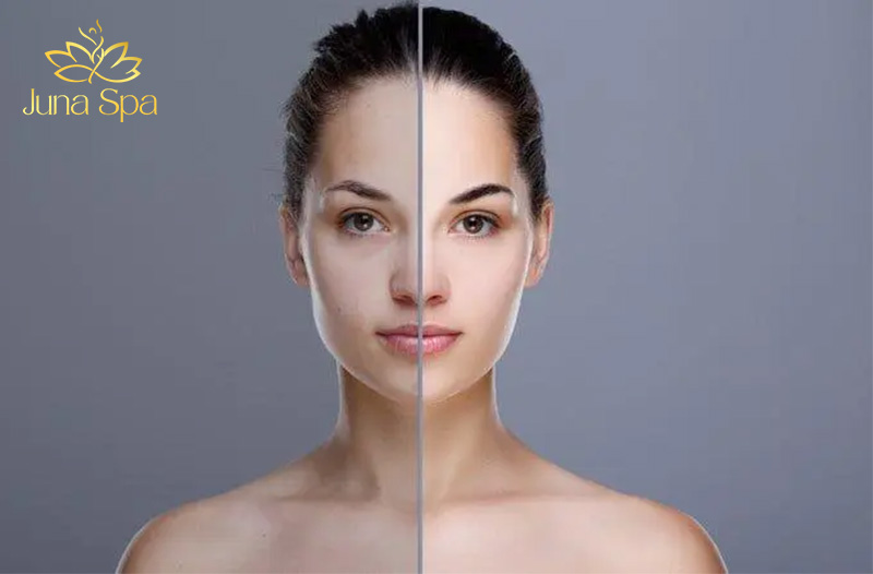 khắc phục da không đều màu