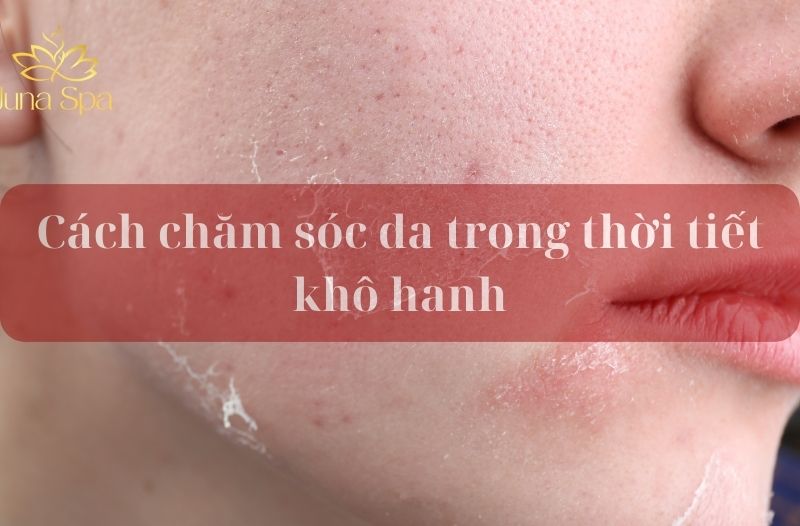 chăm sóc da thời tiết khô hanh