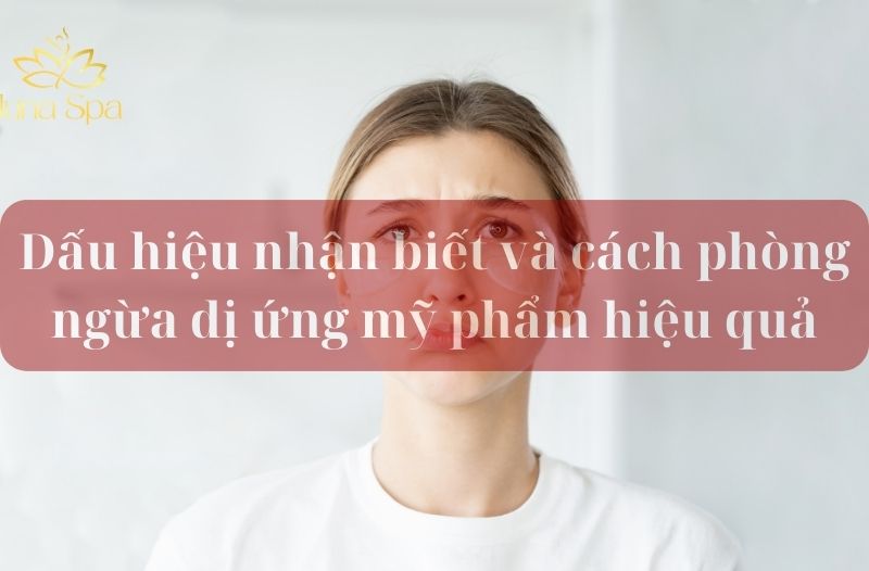 dị ứng mỹ phẩm