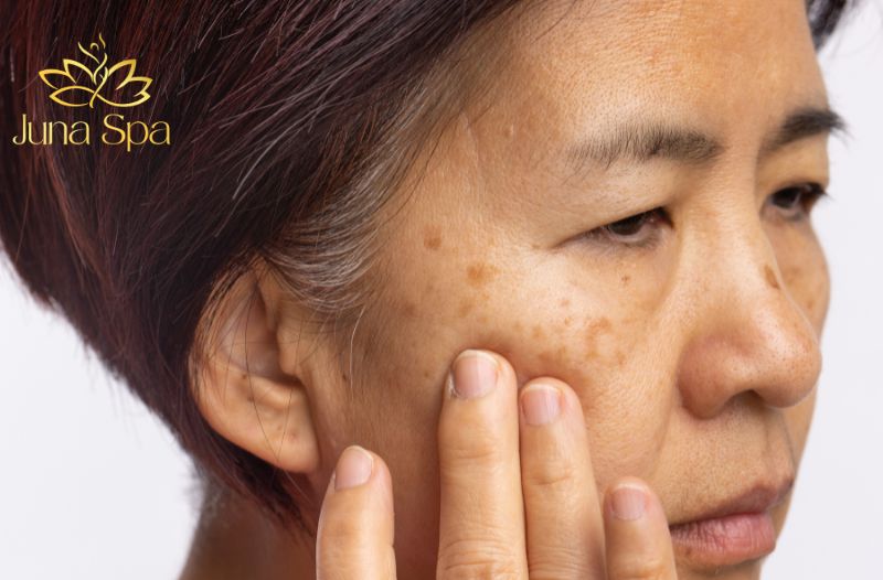 tác nhân gây nám từ bên trong