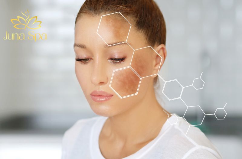 Nám Da và Những Lầm Tưởng Phổ Biến