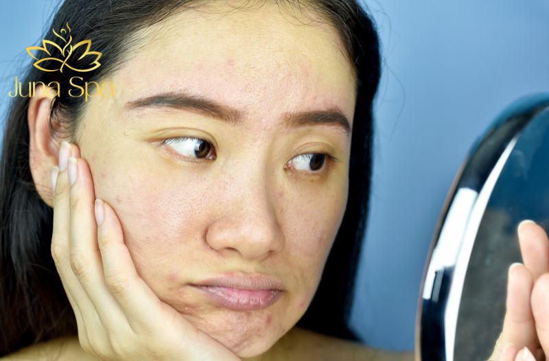 Làn da xỉn màu và thiếu sức sống