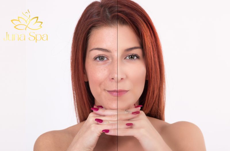 Vì sao collagen lại quan trọng với làn da
