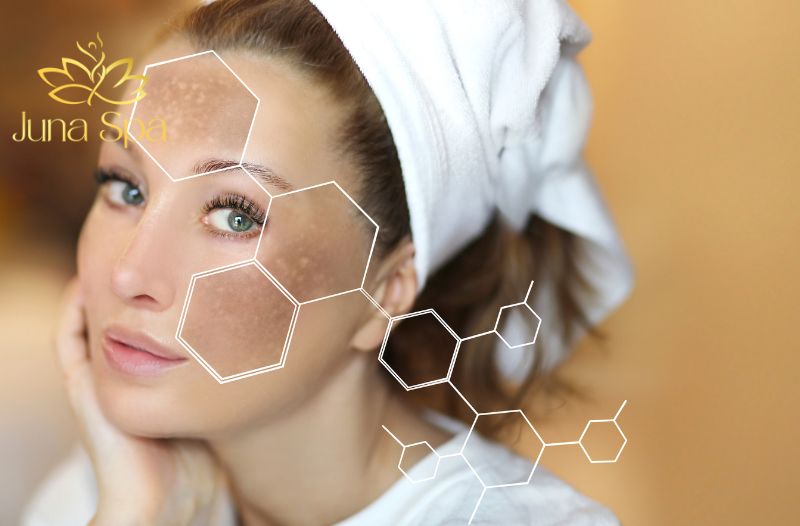 Nám chỉ xuất hiện trên da mặt