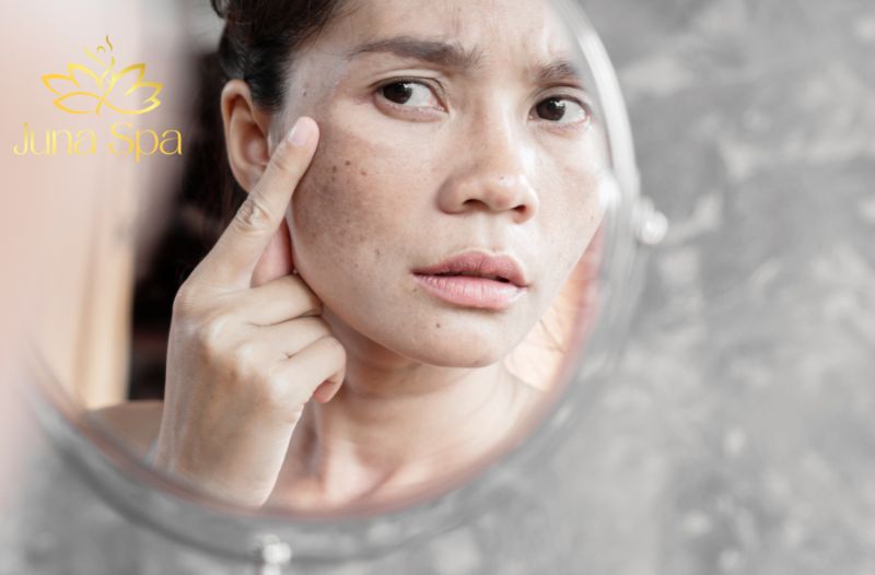 điều trị nám tuổi trung niên