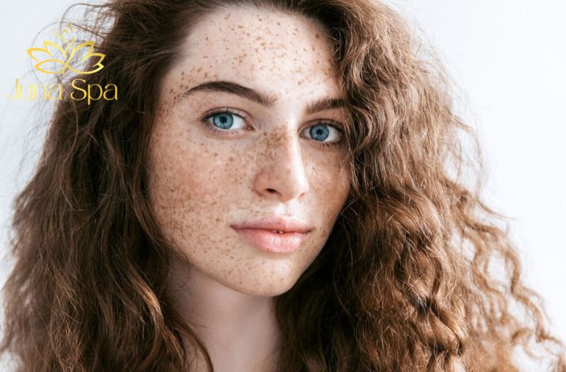 Nám cánh bướm và cánh mảng có gì giống và khác nhau